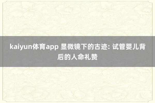 kaiyun体育app 显微镜下的古迹: 试管婴儿背后的人命礼赞